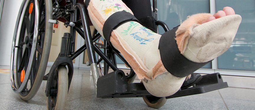 Bills after accident