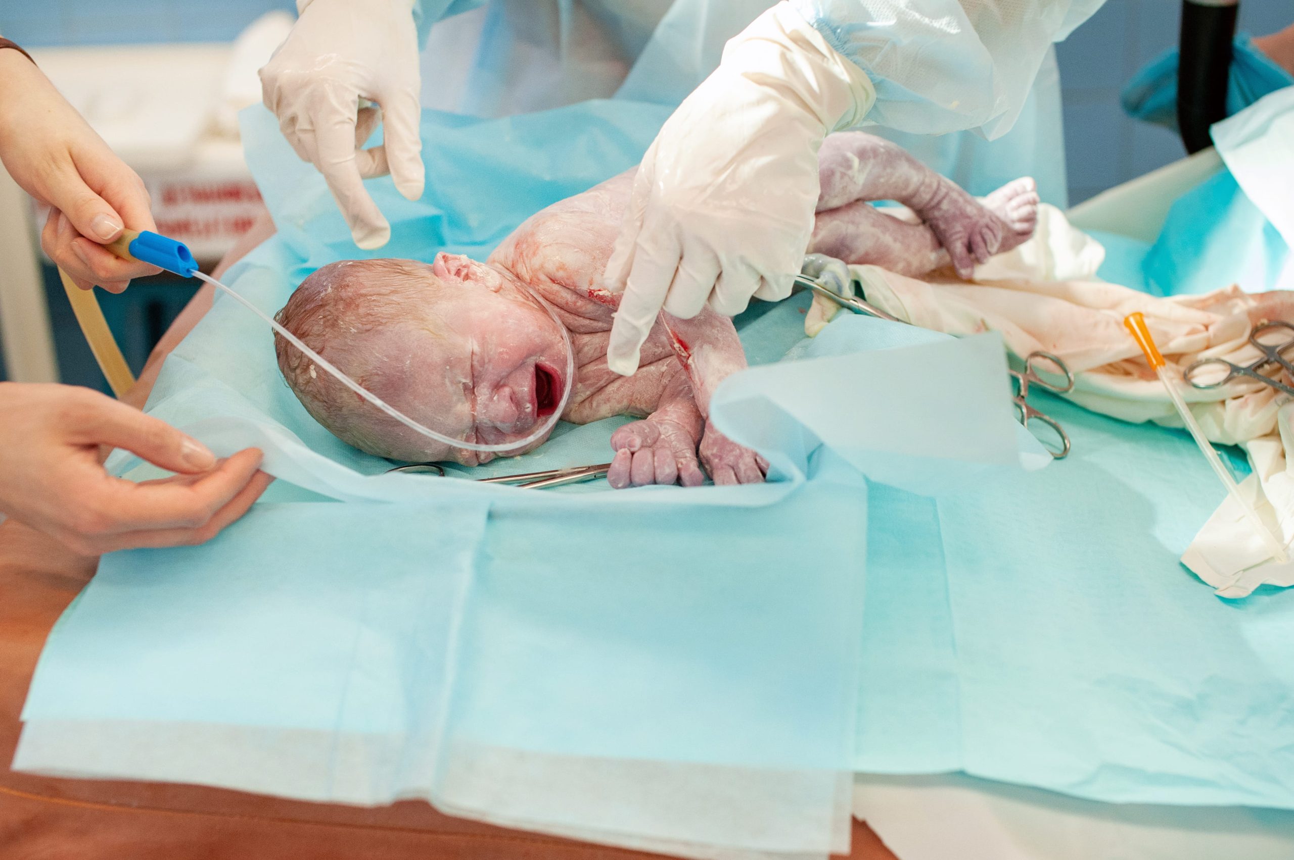 Birth Injuries in Fort Lauderdale
