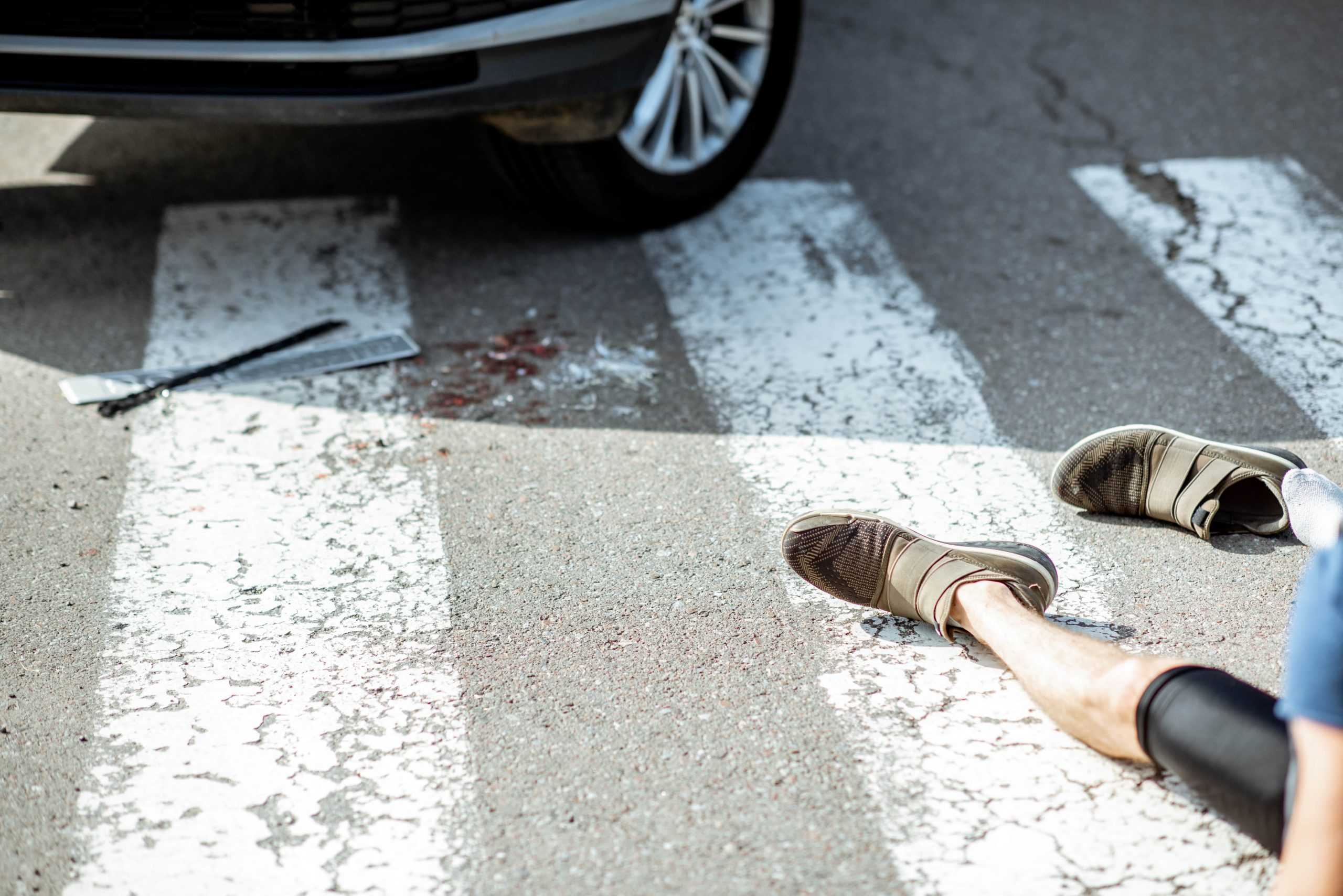 Common injuries in a pedestrian crash