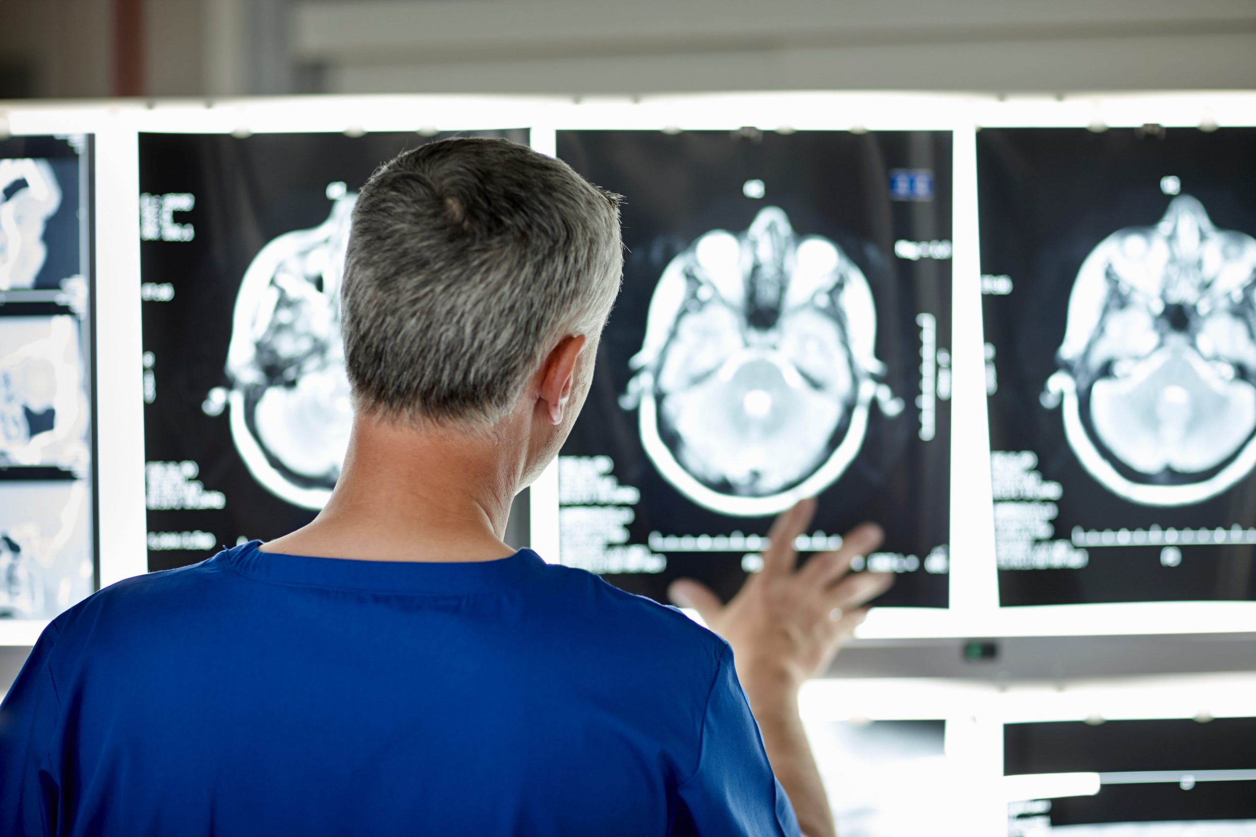 florida mild tbi diagnostic evidence