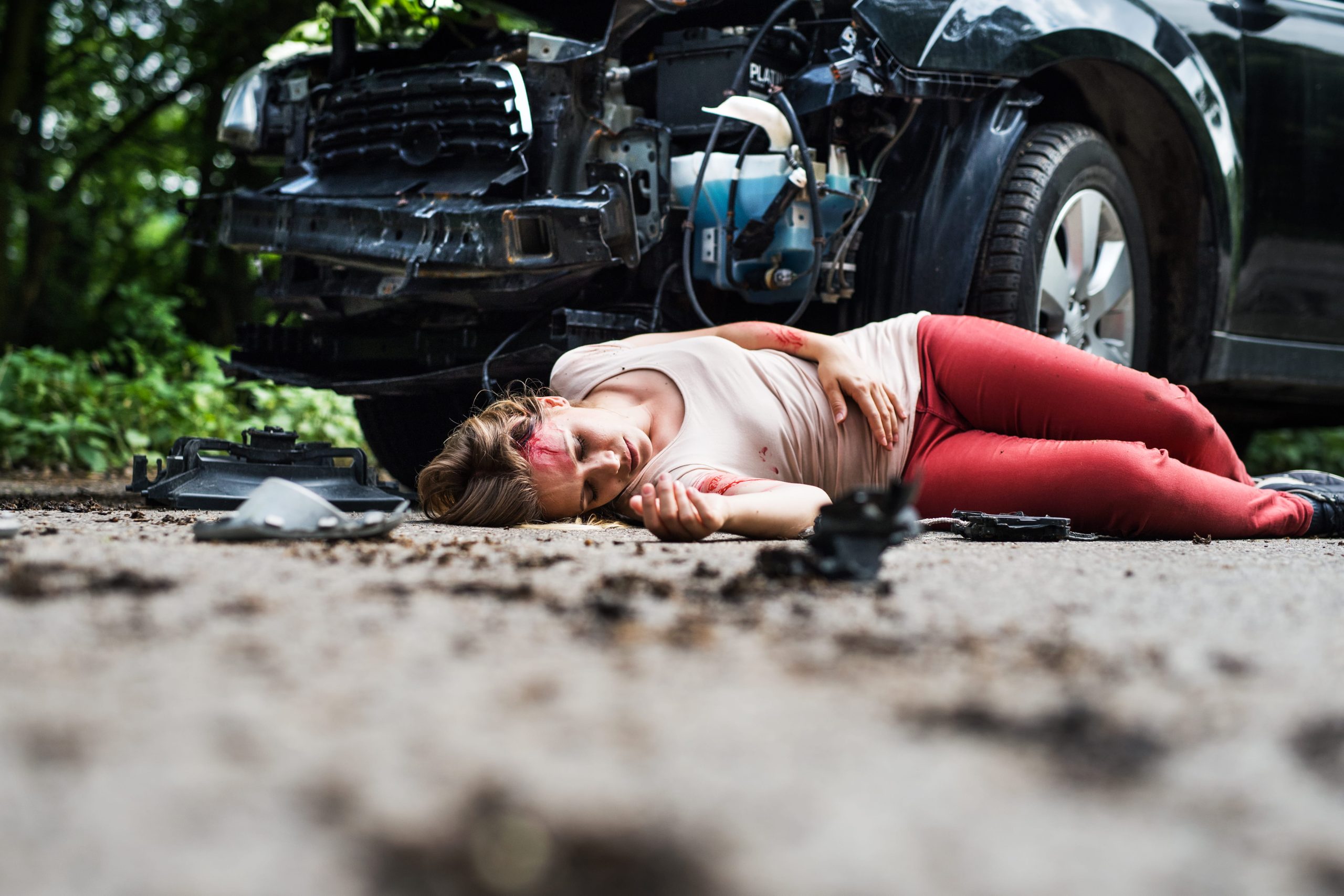 tbi car accident