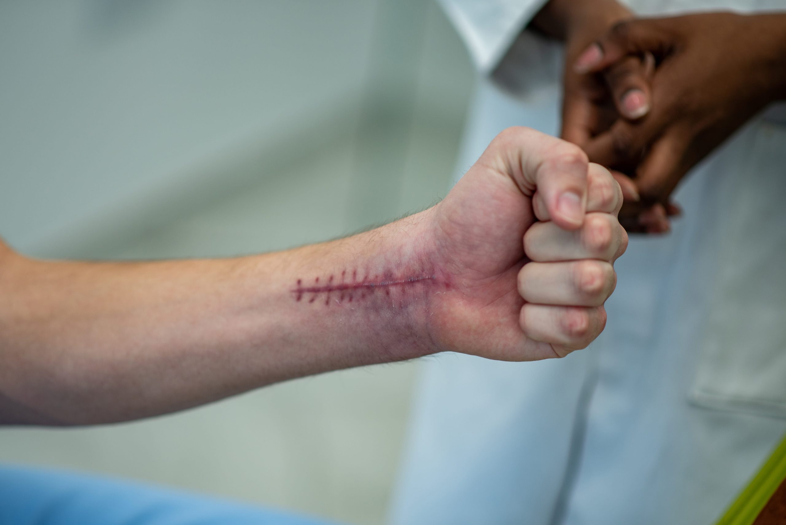 Injuries and why prompt action matters